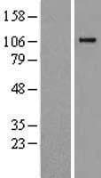 Human Complement C6 Protein (Over-Expression Lysate Myc-DDK (Flag))