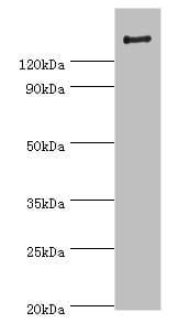 ROCK2 Antibody (aa1109-1388)