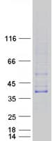 Human TREML1 / TLT1 Protein (Recombinant Myc-DDK (Flag))