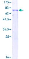 Human DDC / DOPA Decarboxylase Protein (Recombinant GST)