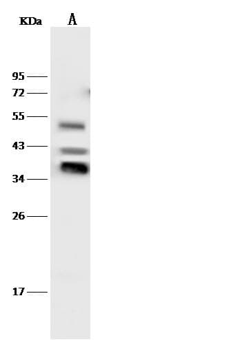 MSX1 Antibody (Preservative Free)
