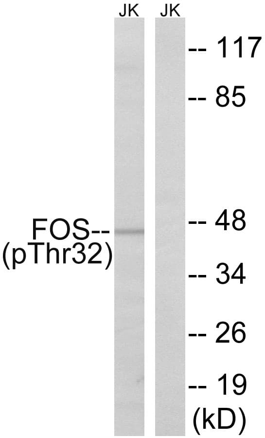FOS / c-FOS Antibody (phospho-Ser32)