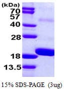 Human SNIP1 Protein (Recombinant His)