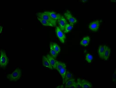 TMEM150A Antibody