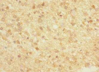 FBXO2 Antibody