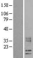 WFDC5 / PRG5 Protein (Over-Expression Lysate Myc-DDK (Flag))