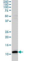 IHC-plus™ Monoclonal Mouse anti-Human TXN / Thioredoxin / TRX Antibody (clone 2A7, IHC, IF, WB)