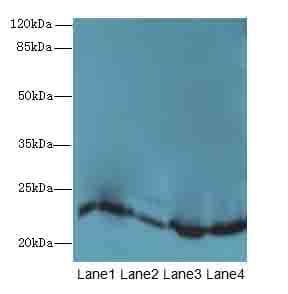 Polyclonal Rabbit anti-Human HPCAL4 Antibody (WB)