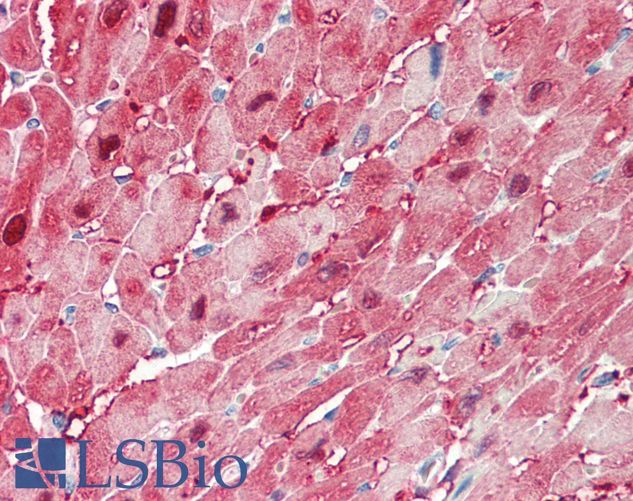 IHC-plus™ FABP3 / H-FABP Antibody (aa39-53)