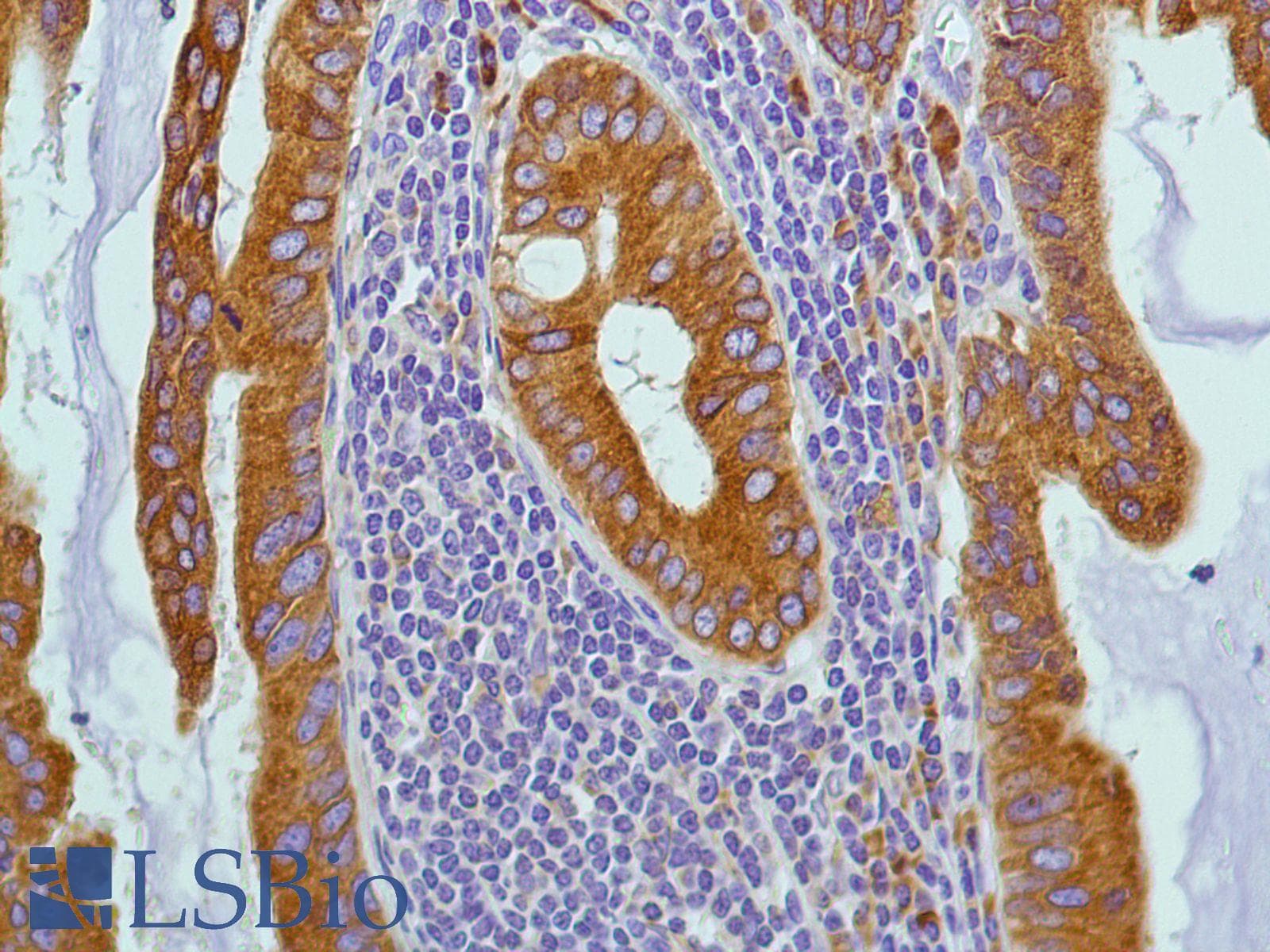 PTGS2 / COX2 / COX-2 Antibody (C-Terminus, clone SP21)