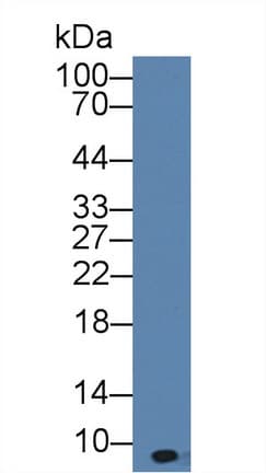 CXCL7 / PPBP Antibody (aa40-113)