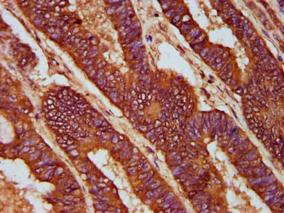 CD2AP Antibody