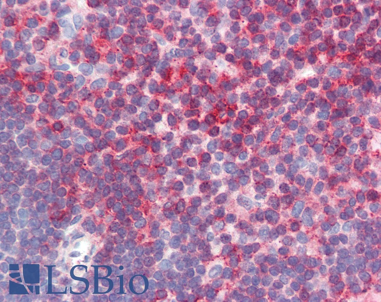 PathPlus™ CD44 Antibody (clone MEM-85)