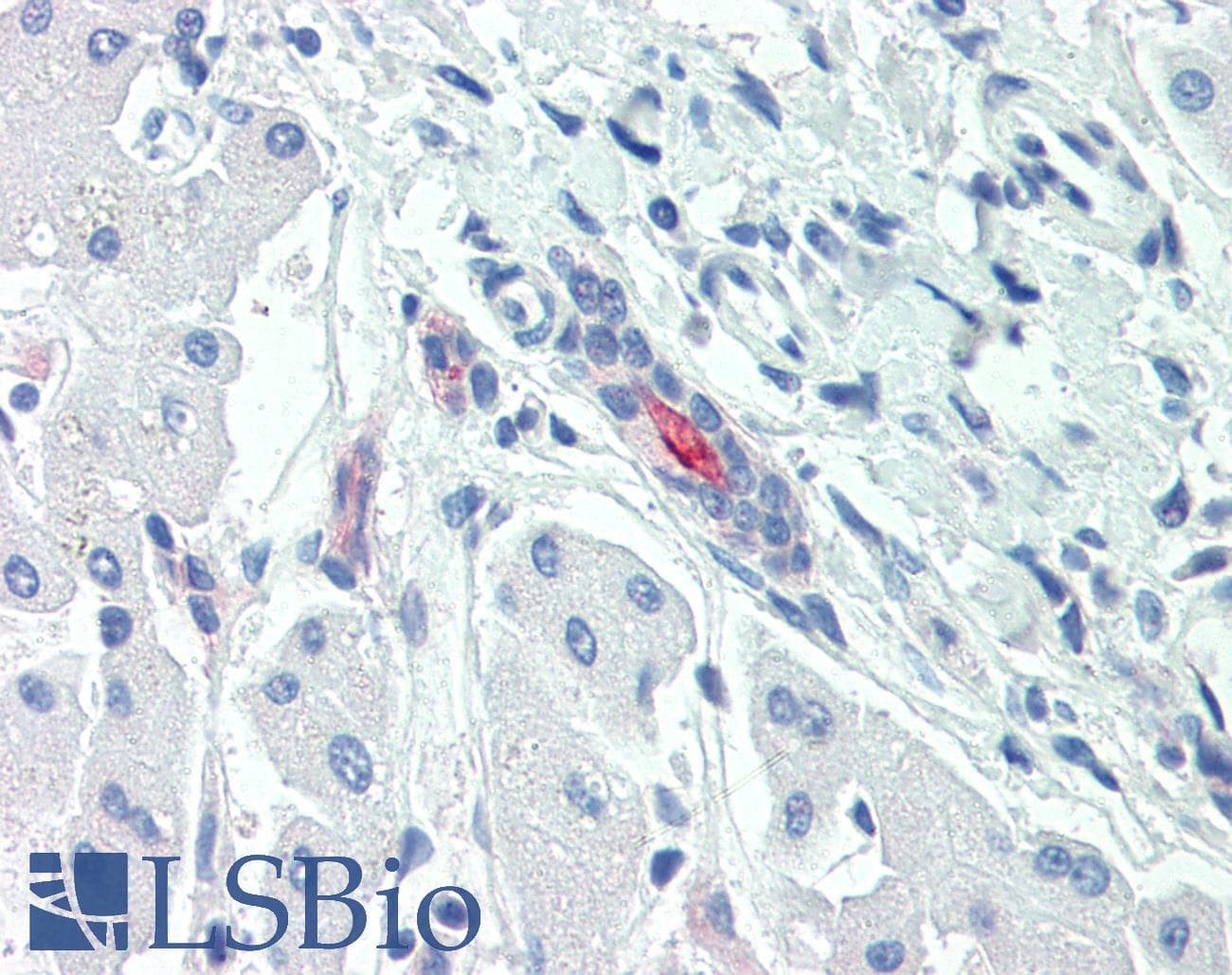 IHC-plus™ Polyclonal Rabbit anti-Human SLC5A1 / SGLT1 Antibody (Internal, IHC)
