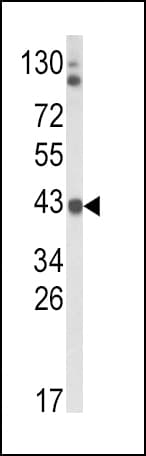 IHC-plus™ Polyclonal Rabbit anti-Human ADH5 Antibody (aa212-239, IHC, WB)