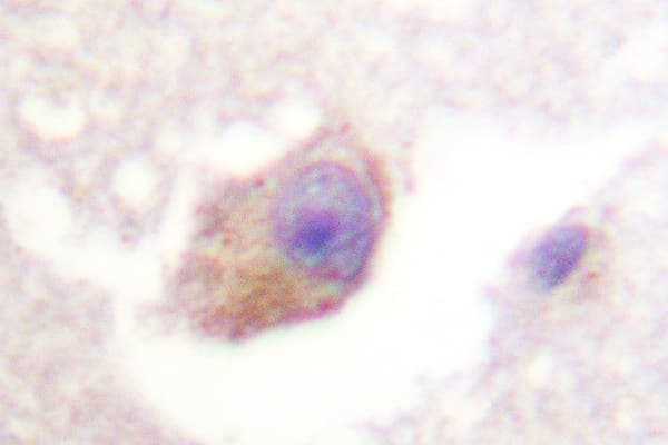 TPH1 / Tryptophan Hydroxylase Antibody (Lys54)