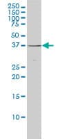 Monoclonal Mouse anti-Human MAGEA11 Antibody (clone 3A6, WB)
