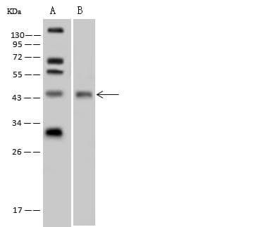 TTF1 / Txn Termination Factor Antibody