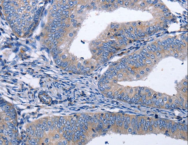 BDNF Antibody