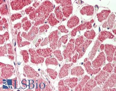 Cardiolipin Synthase / CRLS1 Antibody (aa107-156)