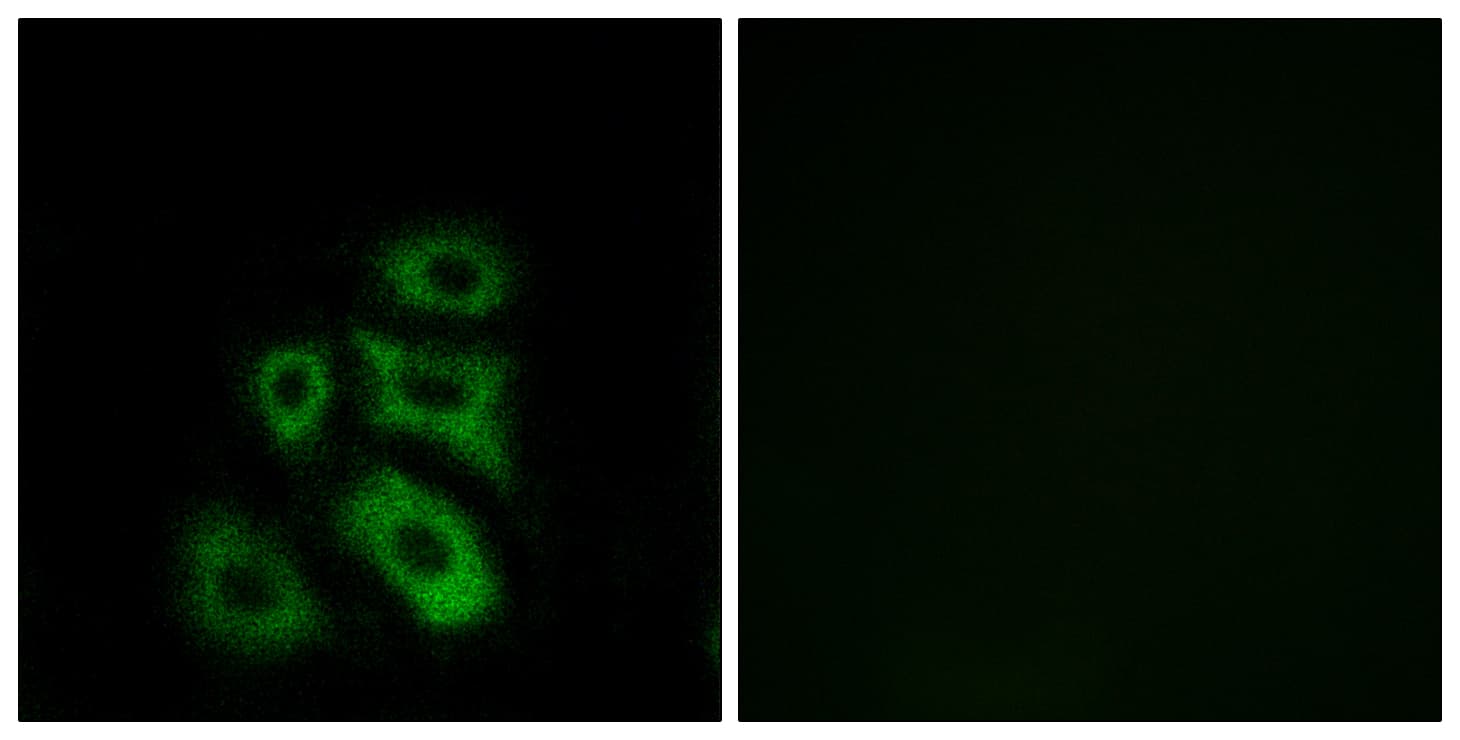 CLIP3 Antibody (aa361-410)