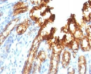 KRT19 / CK19 / Cytokeratin 19 Antibody (clone KRT19/800)
