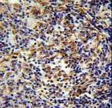Polyclonal Rabbit anti-Human CASKIN2 Antibody (aa714-741, IHC, WB)