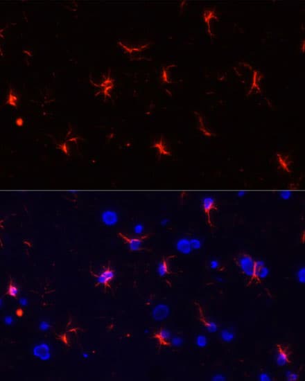 GFAP Antibody