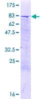 Human CCDC112 / MBC1 Protein (Recombinant GST)