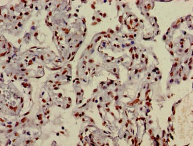 Polyclonal Rabbit anti-Human HIST1H3A Antibody (IHC, IF, WB)