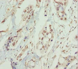 PPP1R8 / Rnase E Antibody