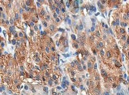 CCK / Cholecystokinin Antibody