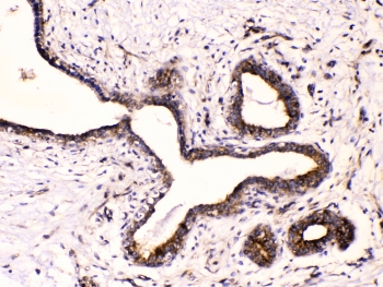 Polyclonal Rabbit anti-Human TUBB3 / Tubulin Beta 3 Antibody (IHC, WB)