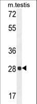 PGAM2 Antibody (aa12-41)