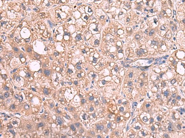 JAZF1 Antibody