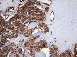 PAI-RBP1 / SERBP1 Antibody (aa1-262, clone OTI2C11)