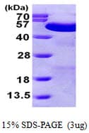 Human PDIA6 / ERP5 Protein (Recombinant His)