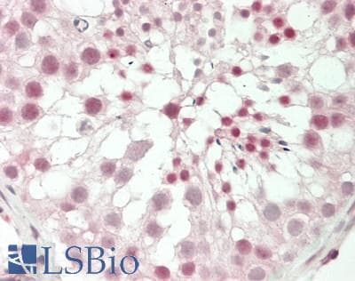 IHC-plus™ Polyclonal Rabbit anti-Human AR / Androgen Receptor Antibody (aa611-660, IHC, WB)