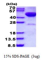 Human STK17B / DRAK2 Protein (Recombinant His)
