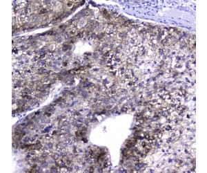 HGD Antibody