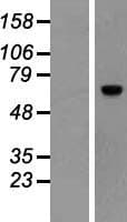 ACBD5 Protein (Over-Expression Lysate Myc-DDK (Flag))