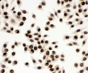 EWSR1 / EWS Antibody