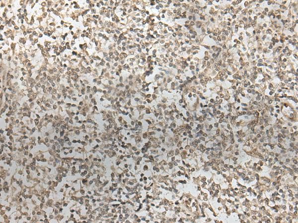 ZNF274 Antibody