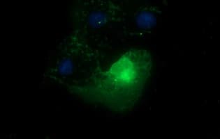 EPCAM Antibody (clone OTI1E9, Carrier-free)