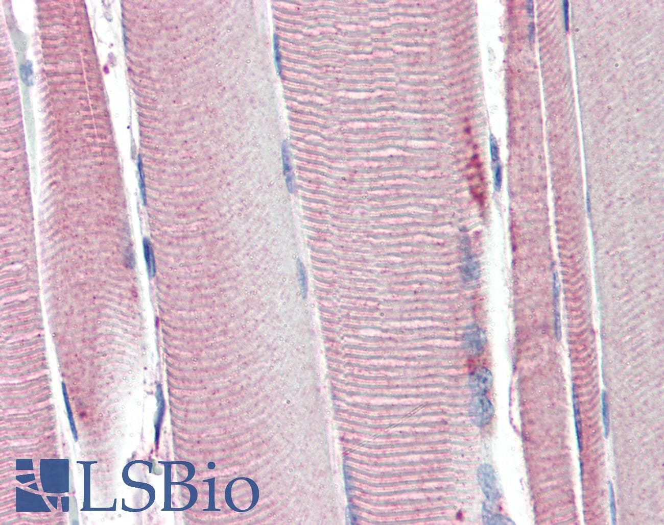 IHC-plus™ Polyclonal Goat anti-Human UCP2 Antibody (aa101-113, IHC, IF, WB)