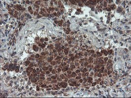 Monoclonal Mouse anti-Human PPP1R15A / GADD34 Antibody (clone OTI4F1, IHC, IF, WB)