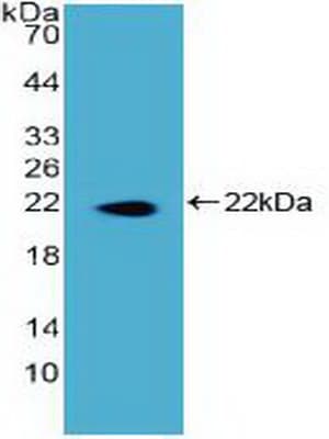 DKC1 / Dyskerin Antibody (aa298-465)
