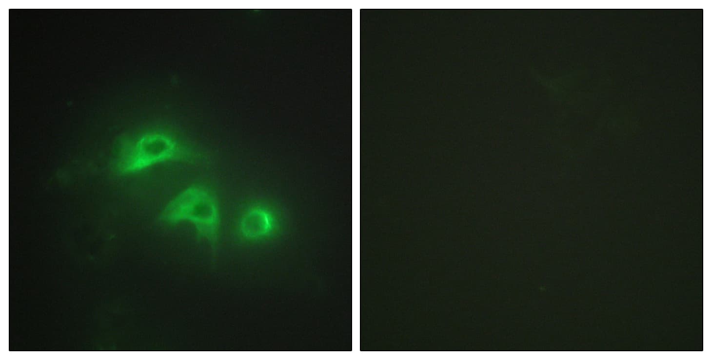 IHC-plus™ AK1 / Adenylate Kinase 1 Antibody (aa101-150)