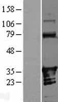 ANKRD54 / LIAR Protein (Over-Expression Lysate Myc-DDK (Flag))