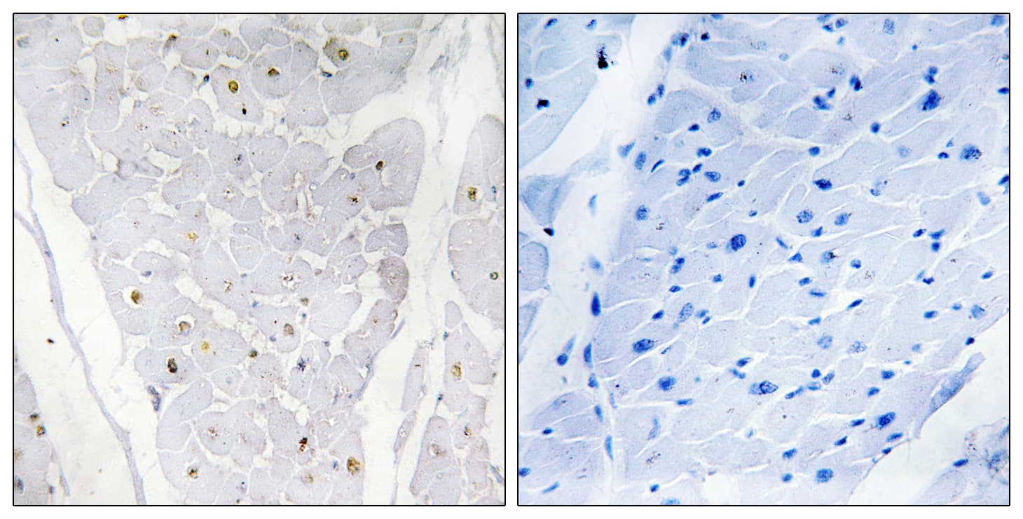HAK / ALPK2 Antibody (aa1741-1790)